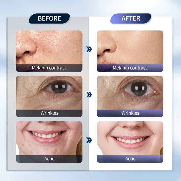 LED Skin Therapy Machine with Hydrating Nano Spray
