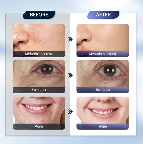 LED Skin Therapy Machine with Hydrating Nano Spray